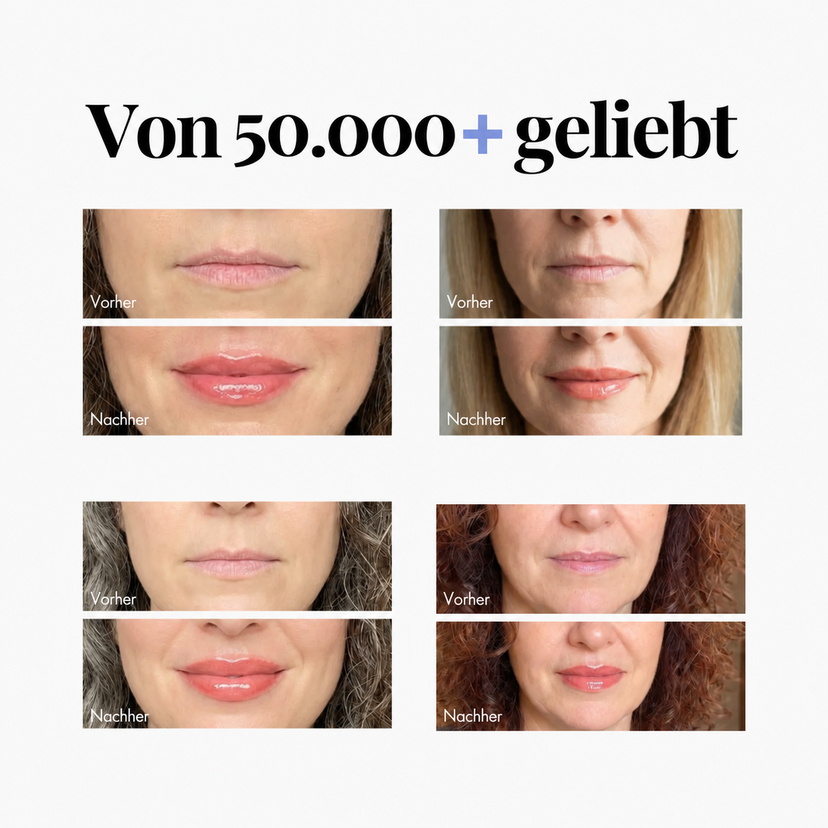 VolumenKuss Extreme – Das intensiv aufpolsternde Lippenserum