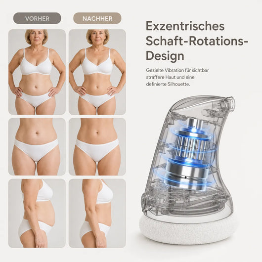 Formkur - Anti-Cellulite- & Bindegewebs-Massagegerät